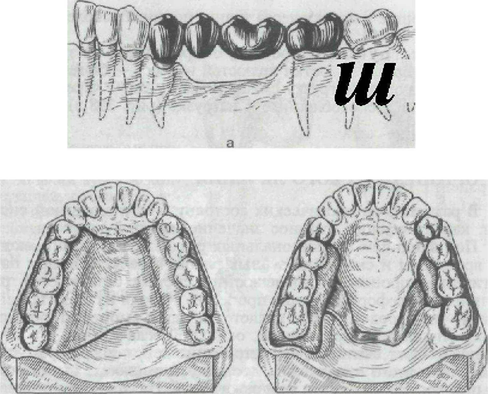 Рисование зубов