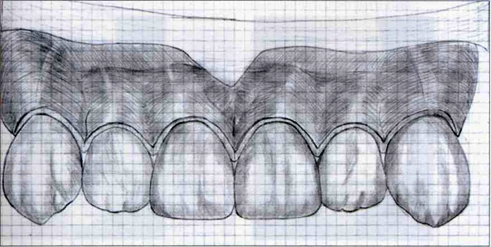 Рисование зубов карандашом